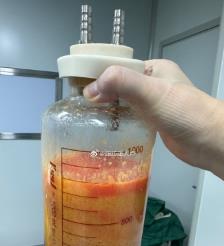 嘉鱼水动力吸脂手术要做多久？